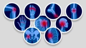 Chronic pain management
